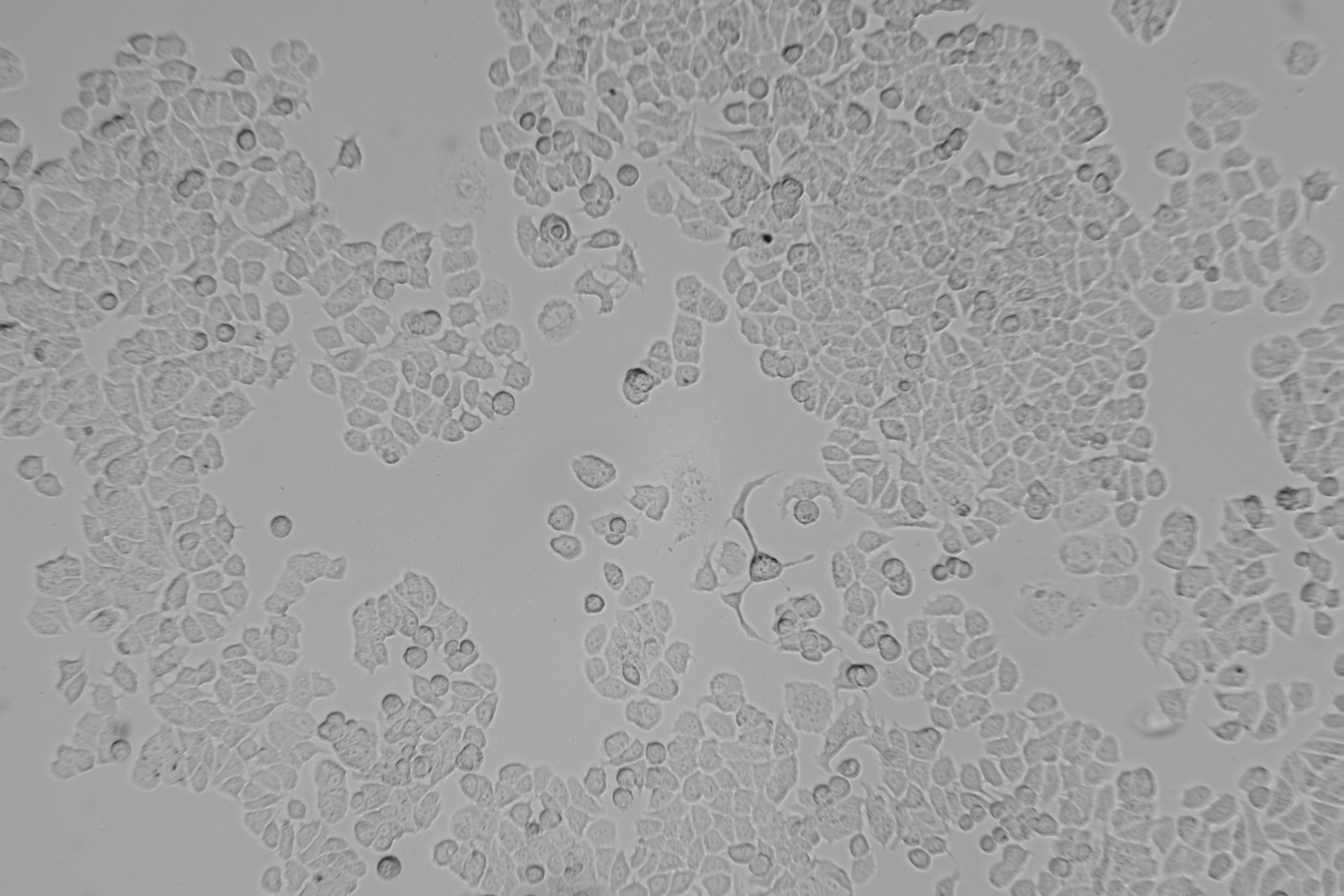 人乳腺癌顺铂耐药株MCF7/DDP